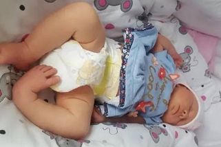 Vzácný případ v Ostravě: Dívka se narodila s koňskou nohou. Čeká ji operace